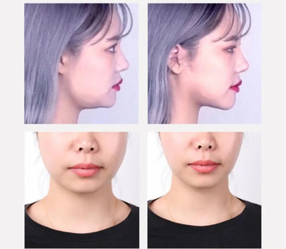 Fitas Elevadoras V-Face Invisíveis shopjponline.com